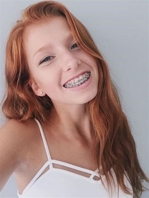 redhead with braces porn